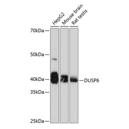 Western Blot - Anti-DUSP6 Antibody [ARC0237] (A305412) - Antibodies.com