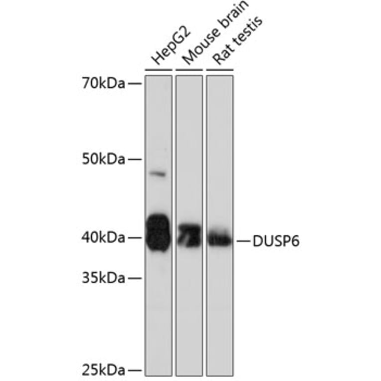Western Blot - Anti-DUSP6 Antibody [ARC0237] (A305412) - Antibodies.com