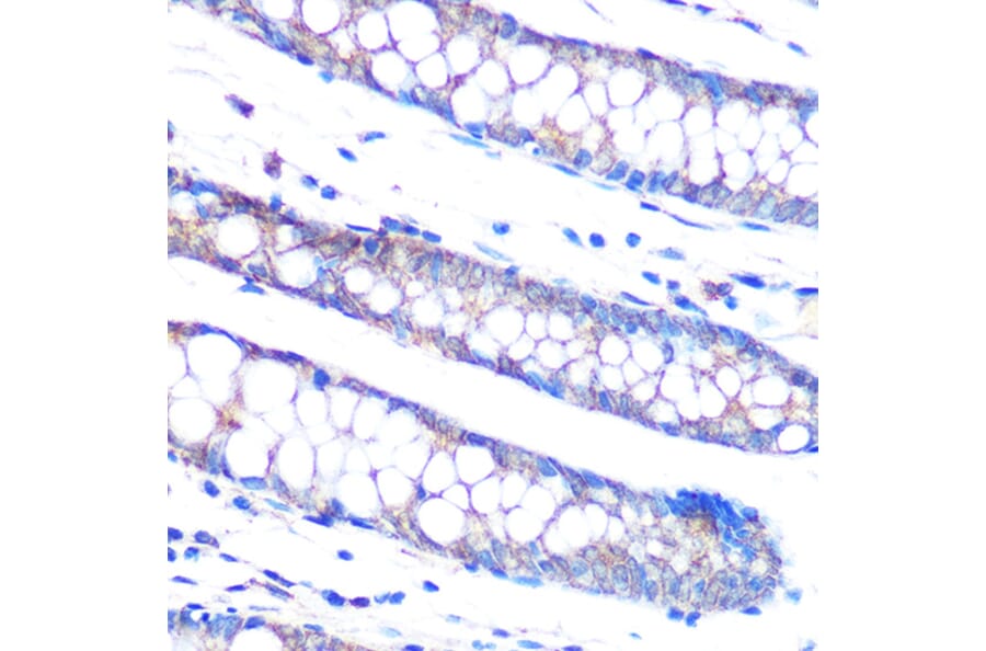 Immunohistochemistry - Anti-DUSP6 Antibody [ARC0237] (A305412) - Antibodies.com