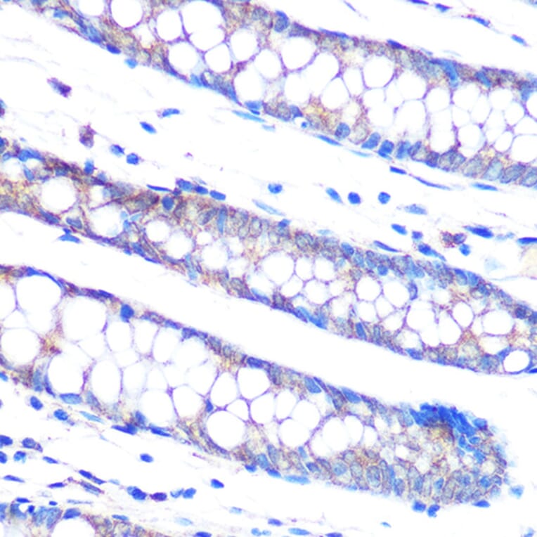 Immunohistochemistry - Anti-DUSP6 Antibody [ARC0237] (A305412) - Antibodies.com