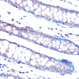 Immunohistochemistry - Anti-DUSP6 Antibody [ARC0237] (A305412) - Antibodies.com