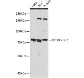 Western Blot - Anti-XPD Antibody [ARC2401] (A305413) - Antibodies.com