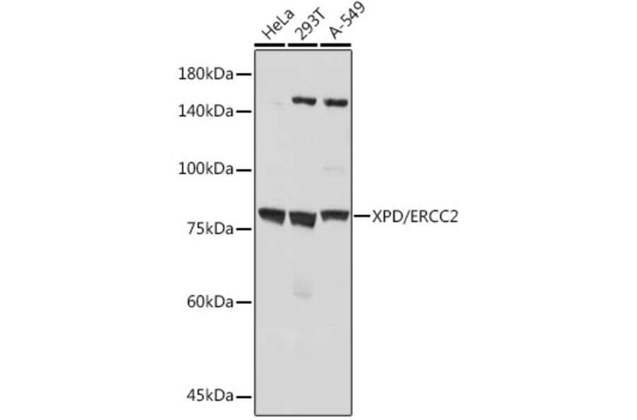 Western Blot - Anti-XPD Antibody [ARC2401] (A305413) - Antibodies.com