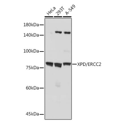 Western Blot - Anti-XPD Antibody [ARC2401] (A305413) - Antibodies.com