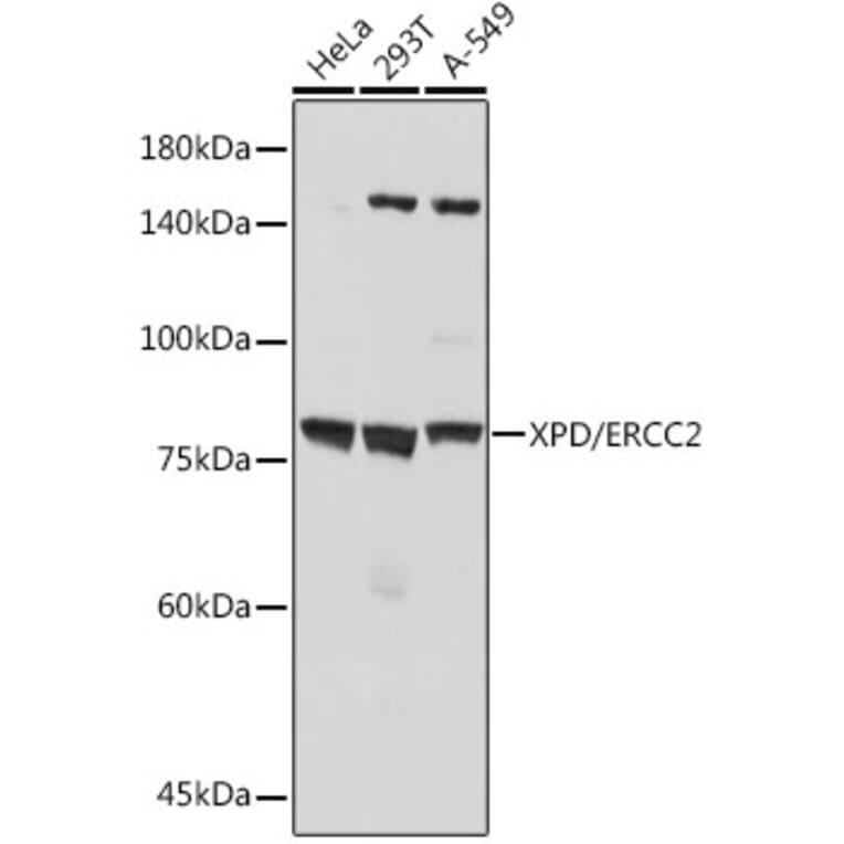 Western Blot - Anti-XPD Antibody [ARC2401] (A305413) - Antibodies.com
