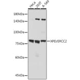 Western Blot - Anti-XPD Antibody [ARC2401] (A305413) - Antibodies.com