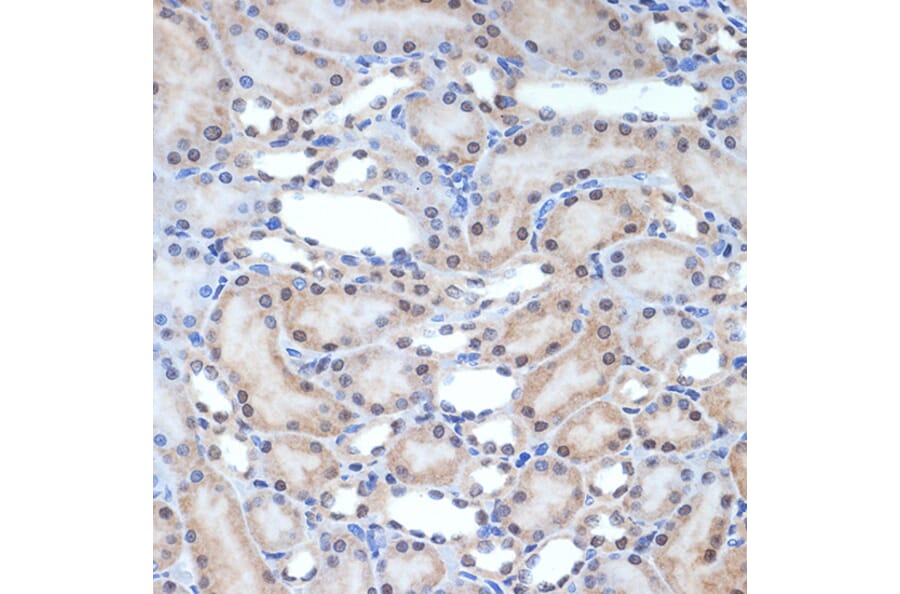 Immunohistochemistry - Anti-XPD Antibody [ARC2401] (A305413) - Antibodies.com