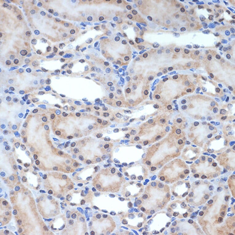 Immunohistochemistry - Anti-XPD Antibody [ARC2401] (A305413) - Antibodies.com
