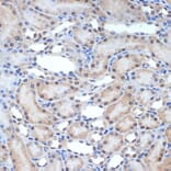 Immunohistochemistry - Anti-XPD Antibody [ARC2401] (A305413) - Antibodies.com