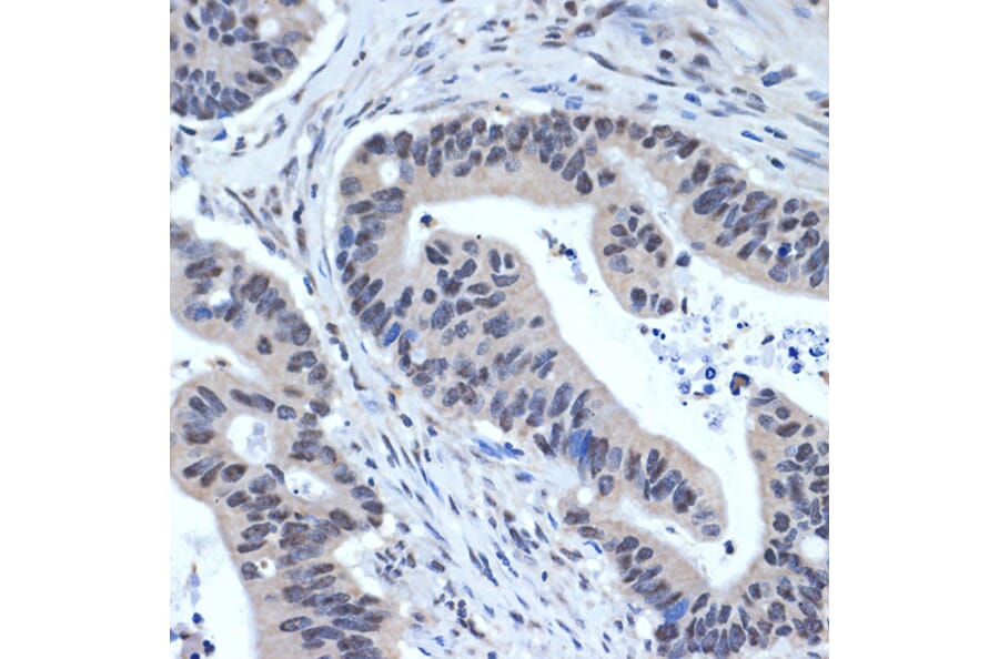 Immunohistochemistry - Anti-XPD Antibody [ARC2401] (A305413) - Antibodies.com