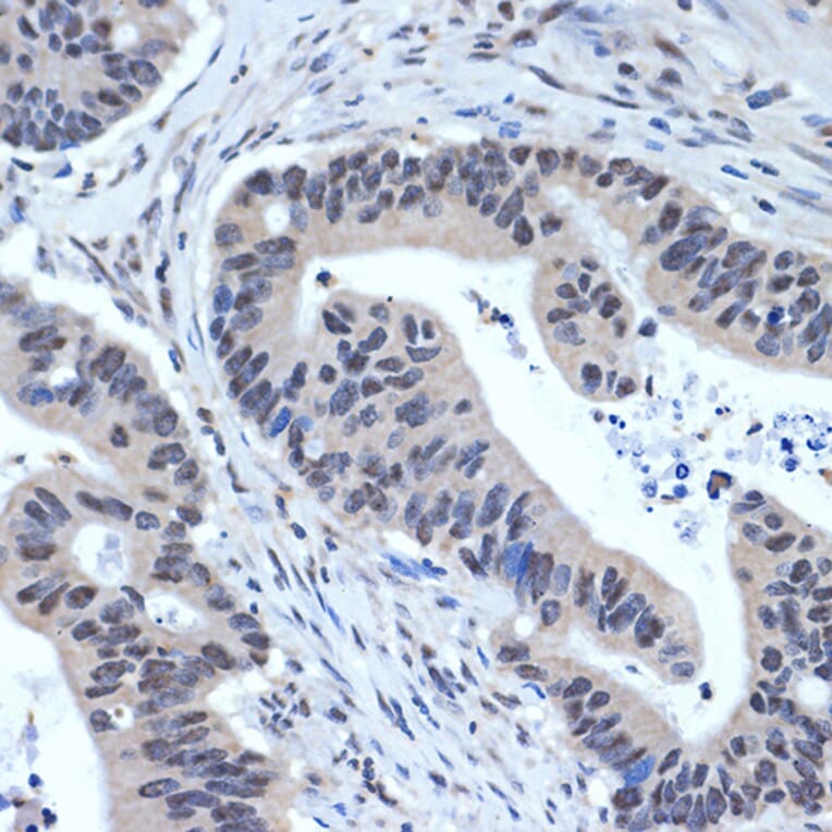 Immunohistochemistry - Anti-XPD Antibody [ARC2401] (A305413) - Antibodies.com