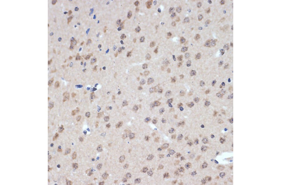 Immunohistochemistry - Anti-XPD Antibody [ARC2401] (A305413) - Antibodies.com