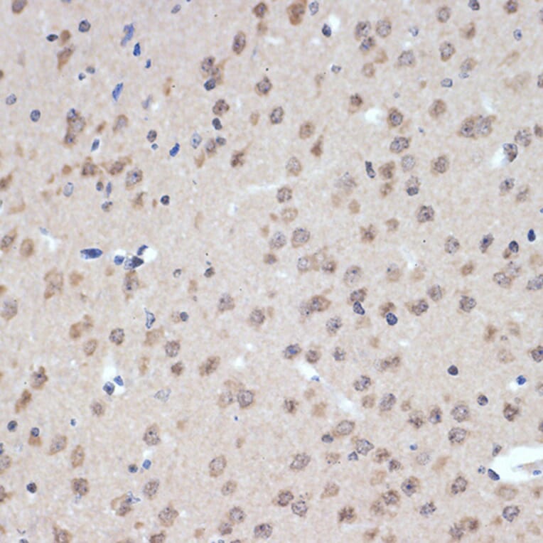 Immunohistochemistry - Anti-XPD Antibody [ARC2401] (A305413) - Antibodies.com