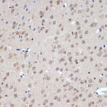 Immunohistochemistry - Anti-XPD Antibody [ARC2401] (A305413) - Antibodies.com
