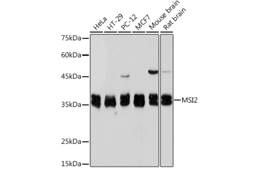 Western Blot - Anti-MSI2 Antibody [ARC2341] (A305414) - Antibodies.com