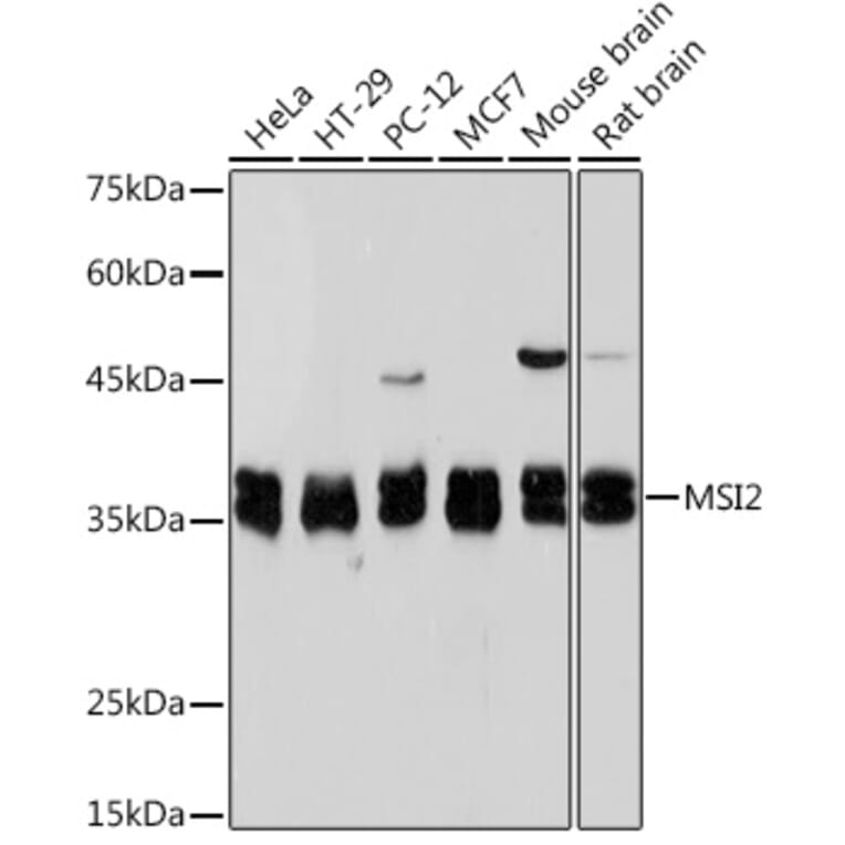 Western Blot - Anti-MSI2 Antibody [ARC2341] (A305414) - Antibodies.com