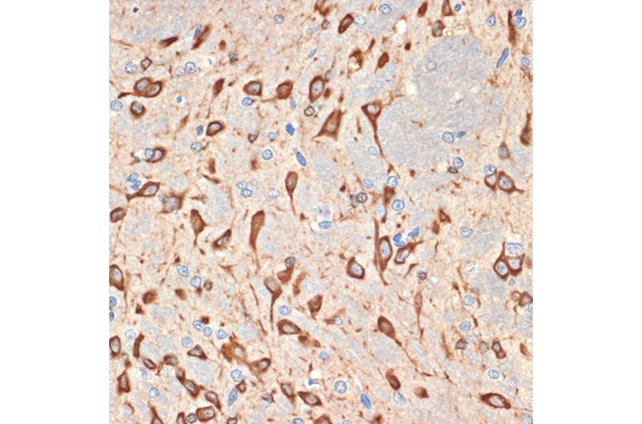 Immunohistochemistry - Anti-MSI2 Antibody [ARC2341] (A305414) - Antibodies.com