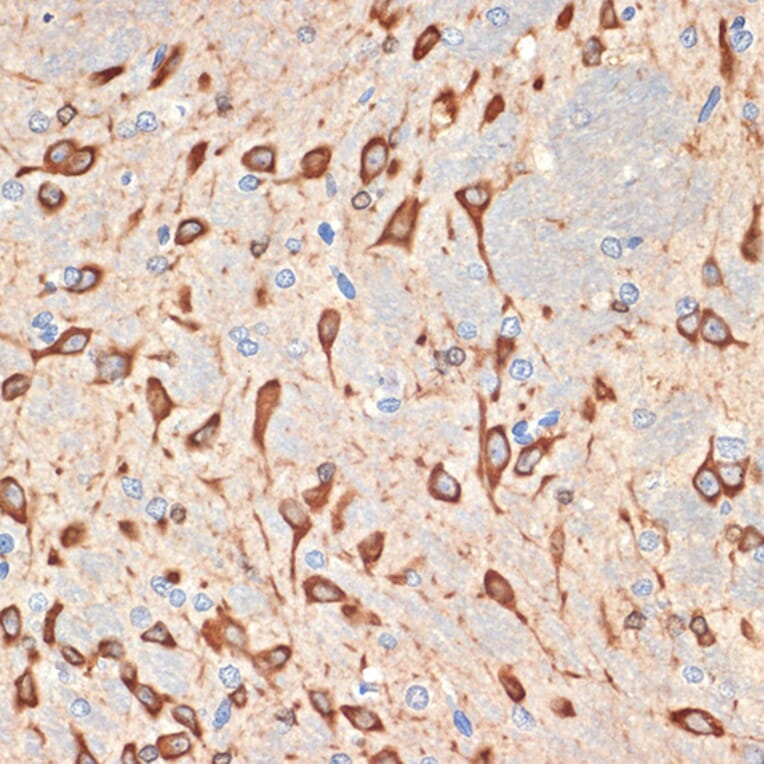 Immunohistochemistry - Anti-MSI2 Antibody [ARC2341] (A305414) - Antibodies.com