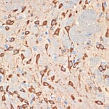 Immunohistochemistry - Anti-MSI2 Antibody [ARC2341] (A305414) - Antibodies.com