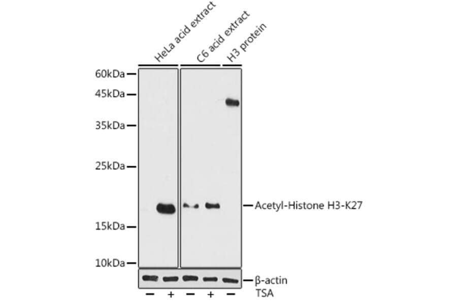 Western Blot - Anti-Histone H3 (acetyl Lys27) Antibody (A305415) - Antibodies.com
