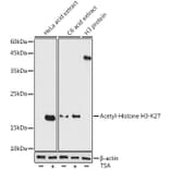 Western Blot - Anti-Histone H3 (acetyl Lys27) Antibody (A305415) - Antibodies.com