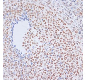 Immunohistochemistry - Anti-Histone H1.4 (acetyl Lys26) Antibody (A305416) - Antibodies.com