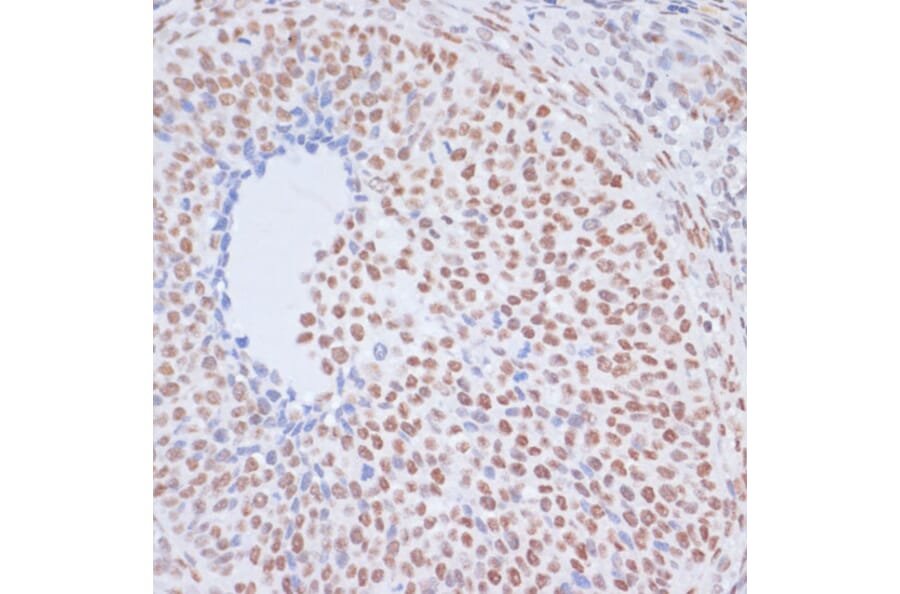 Immunohistochemistry - Anti-Histone H1.4 (acetyl Lys26) Antibody (A305416) - Antibodies.com