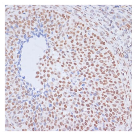 Immunohistochemistry - Anti-Histone H1.4 (acetyl Lys26) Antibody (A305416) - Antibodies.com