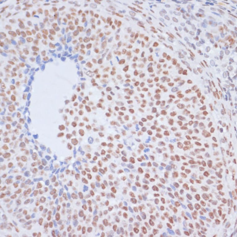 Immunohistochemistry - Anti-Histone H1.4 (acetyl Lys26) Antibody (A305416) - Antibodies.com