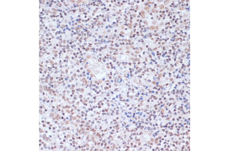 Immunohistochemistry - Anti-Histone H1.4 (acetyl Lys26) Antibody (A305416) - Antibodies.com