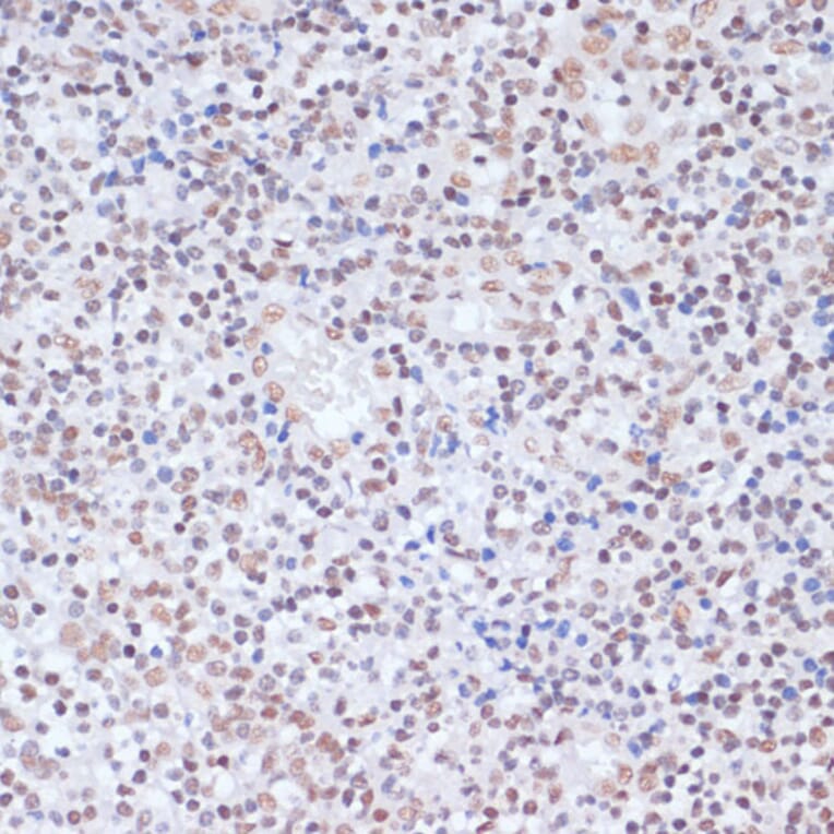 Immunohistochemistry - Anti-Histone H1.4 (acetyl Lys26) Antibody (A305416) - Antibodies.com