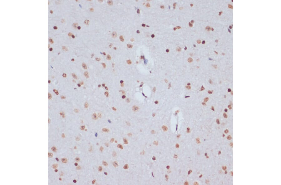 Immunohistochemistry - Anti-Histone H1.4 (acetyl Lys26) Antibody (A305416) - Antibodies.com