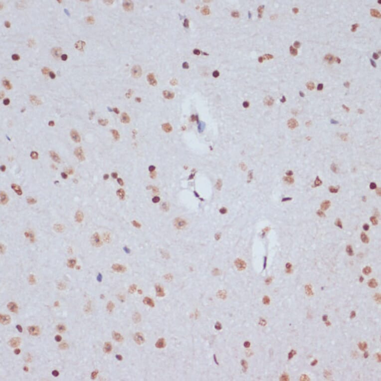 Immunohistochemistry - Anti-Histone H1.4 (acetyl Lys26) Antibody (A305416) - Antibodies.com