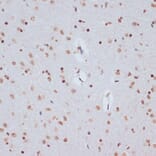 Immunohistochemistry - Anti-Histone H1.4 (acetyl Lys26) Antibody (A305416) - Antibodies.com