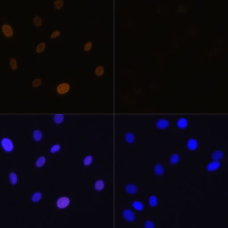 Immunofluorescence - Anti-Histone H1.4 (acetyl Lys26) Antibody (A305416) - Antibodies.com