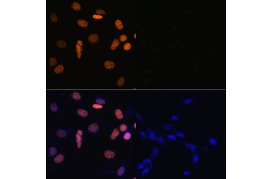 Immunofluorescence - Anti-Histone H1.4 (acetyl Lys26) Antibody (A305416) - Antibodies.com