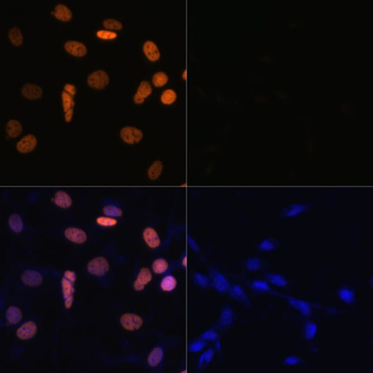 Immunofluorescence - Anti-Histone H1.4 (acetyl Lys26) Antibody (A305416) - Antibodies.com