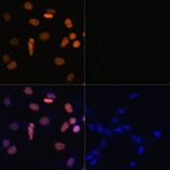 Immunofluorescence - Anti-Histone H1.4 (acetyl Lys26) Antibody (A305416) - Antibodies.com
