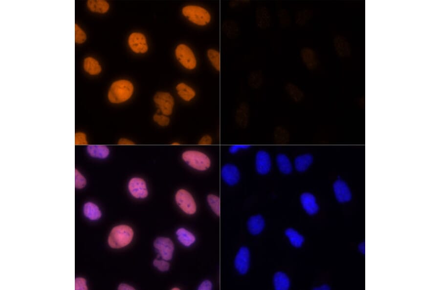 Immunofluorescence - Anti-Histone H1.4 (acetyl Lys26) Antibody (A305416) - Antibodies.com