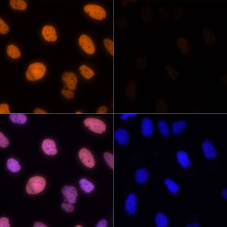 Immunofluorescence - Anti-Histone H1.4 (acetyl Lys26) Antibody (A305416) - Antibodies.com