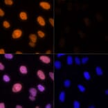 Immunofluorescence - Anti-Histone H1.4 (acetyl Lys26) Antibody (A305416) - Antibodies.com
