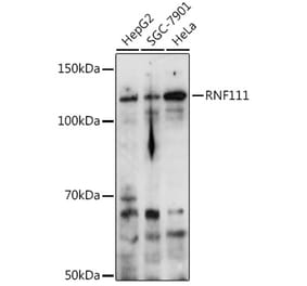 Western Blot - Anti-RNF111 Antibody (A305418) - Antibodies.com