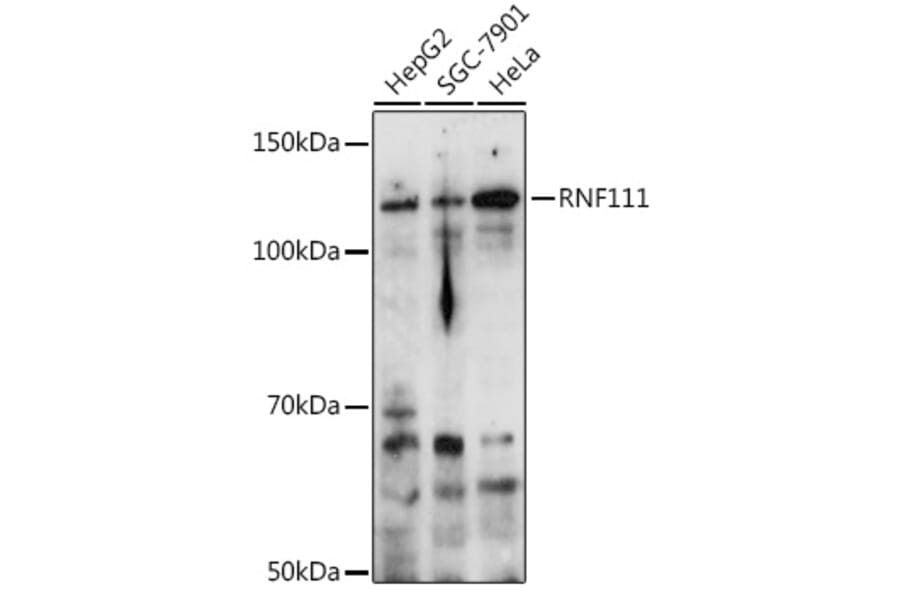 Western Blot - Anti-RNF111 Antibody (A305418) - Antibodies.com