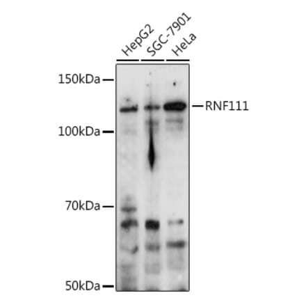 Western Blot - Anti-RNF111 Antibody (A305418) - Antibodies.com