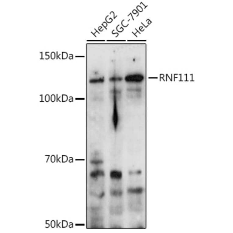 Western Blot - Anti-RNF111 Antibody (A305418) - Antibodies.com