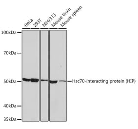 Western Blot - Anti-HSC70 Interacting Protein HIP Antibody [ARC1639] (A305419) - Antibodies.com