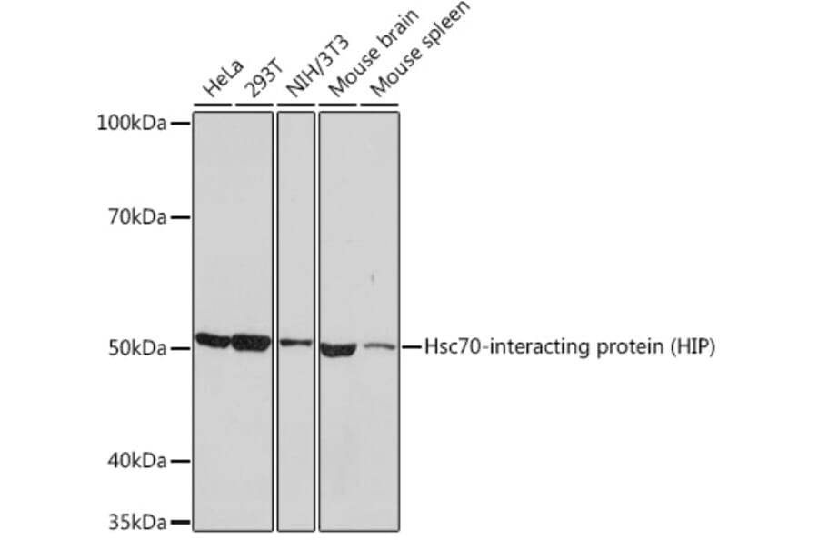 Western Blot - Anti-HSC70 Interacting Protein HIP Antibody [ARC1639] (A305419) - Antibodies.com
