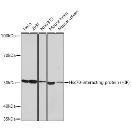 Western Blot - Anti-HSC70 Interacting Protein HIP Antibody [ARC1639] (A305419) - Antibodies.com