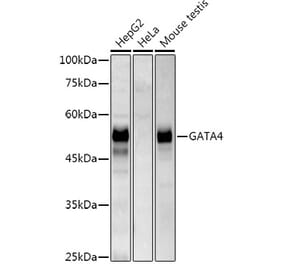 Western Blot - Anti-GATA4 Antibody [ARC51718] (A305425) - Antibodies.com
