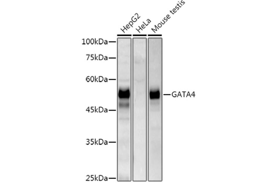 Western Blot - Anti-GATA4 Antibody [ARC51718] (A305425) - Antibodies.com